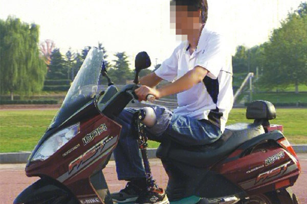 大腿假肢圖片