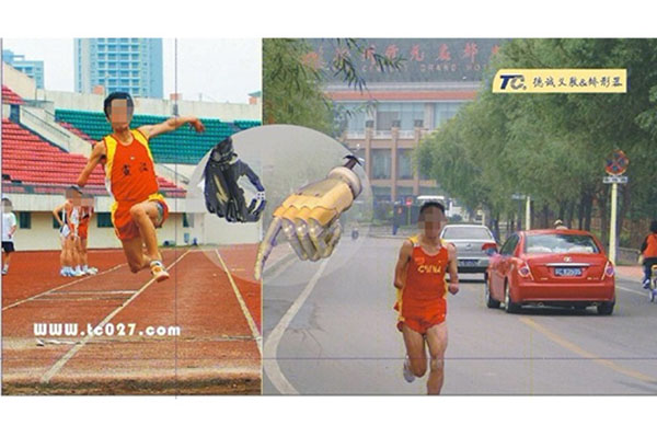 上肢仿生手圖片