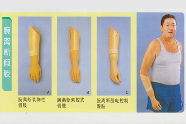 腕離斷假肢