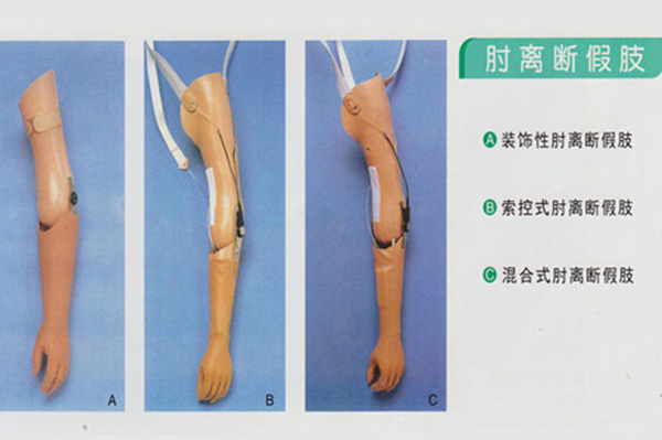肘關節假肢