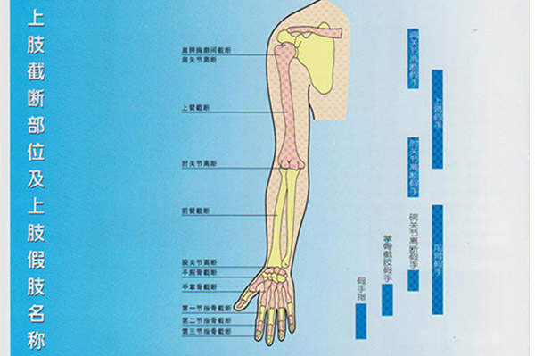 <b>上肢截斷部位及名稱</b>