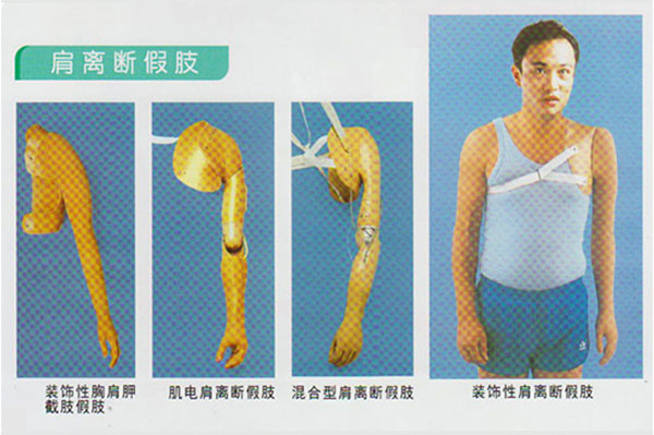 肩離斷假肢